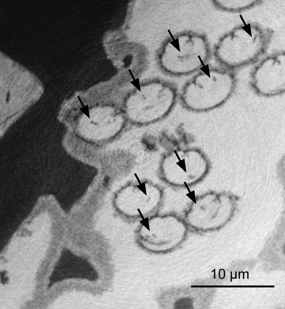 Image of cross-section of 17 million year old fossil ostracod sperm from Riversleigh World Heritage Fossil Site in northwestern Queensland. The nuclei in each sperm (dark spot) are indicated by arrows. Credit: R. Matzke-Karasz
