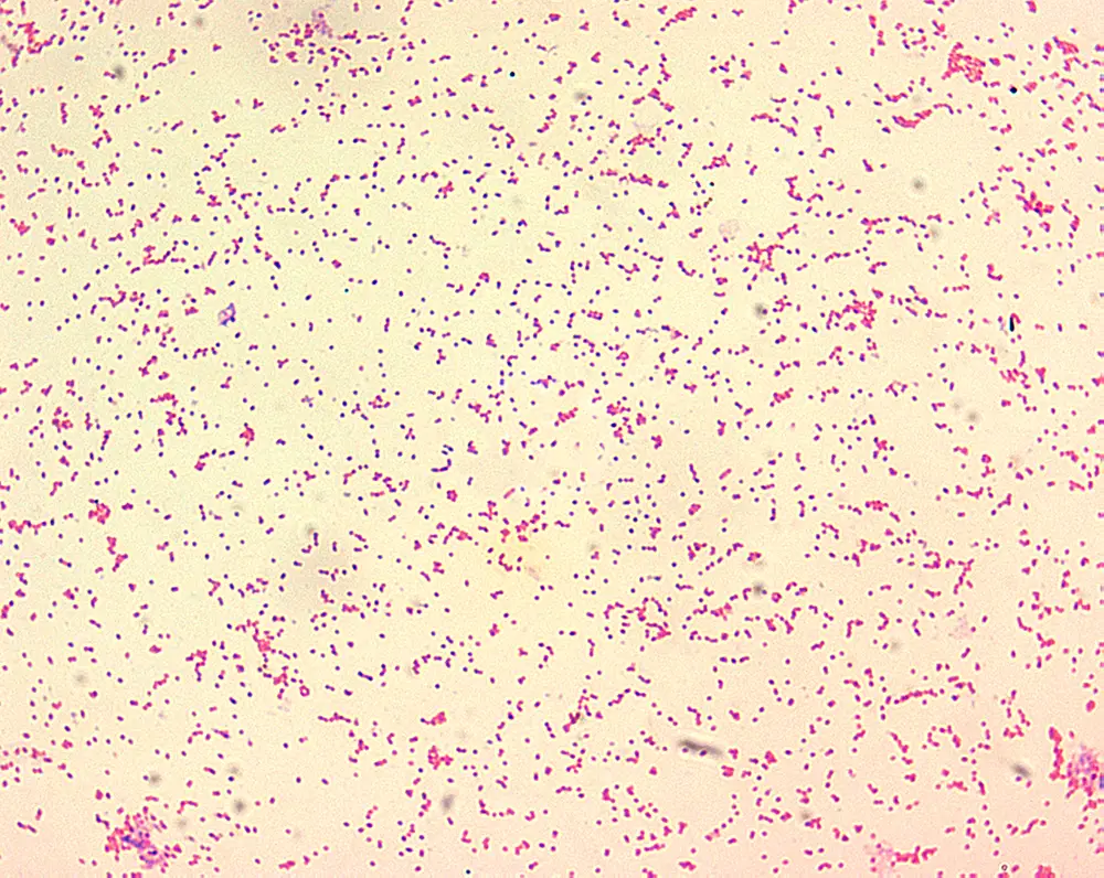 Identifying The Region Responsible For Brucella Abortus Mucr Higher