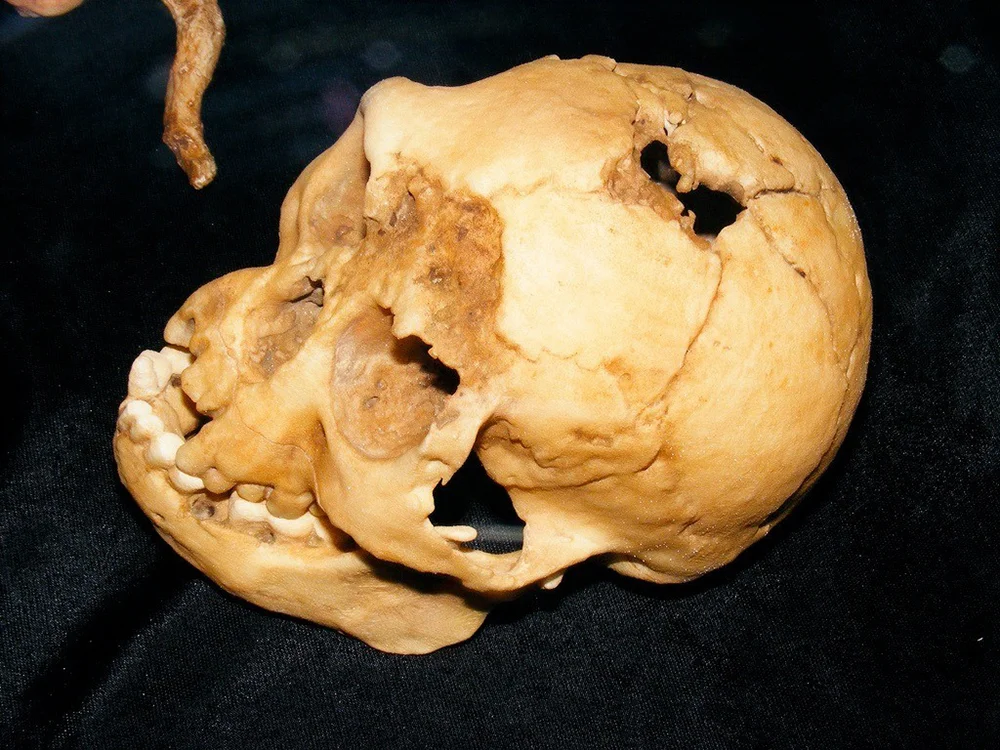 Homo floresiensis: Fotopedia