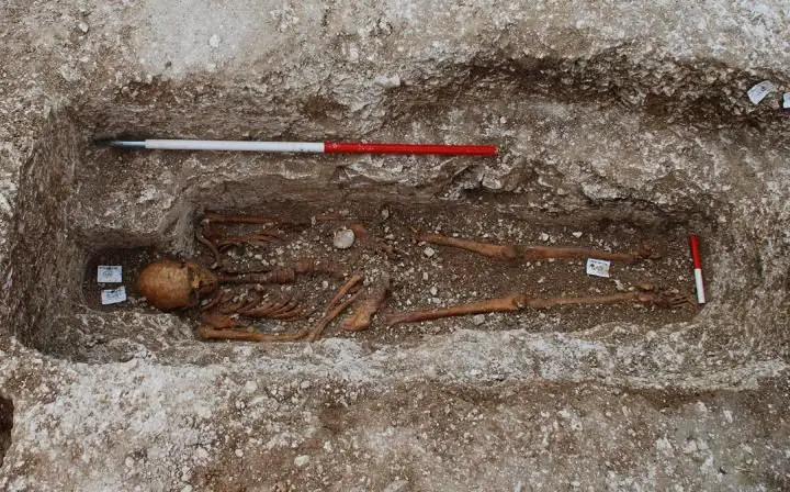 leprosy strain genotyped from medieval pilgrim at uk burial site