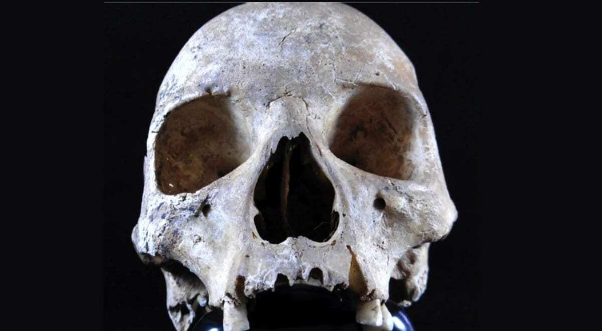 could squirrel trade have contributed to england’s medieval leprosy outbreak?