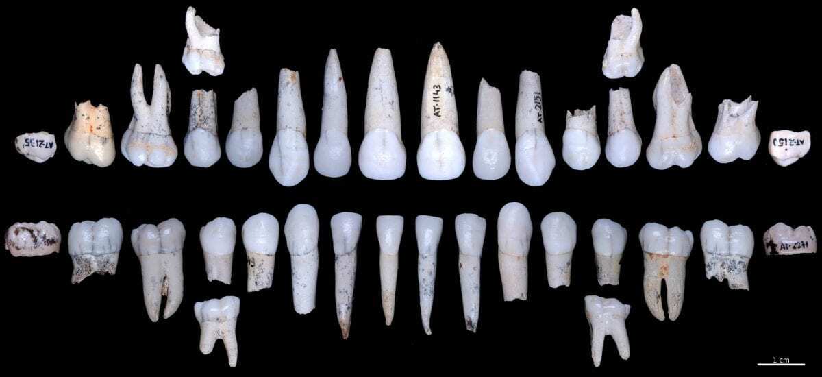 The tooth enamel of the Atapuerca hominids grew faster than in ... - HeritageDaily