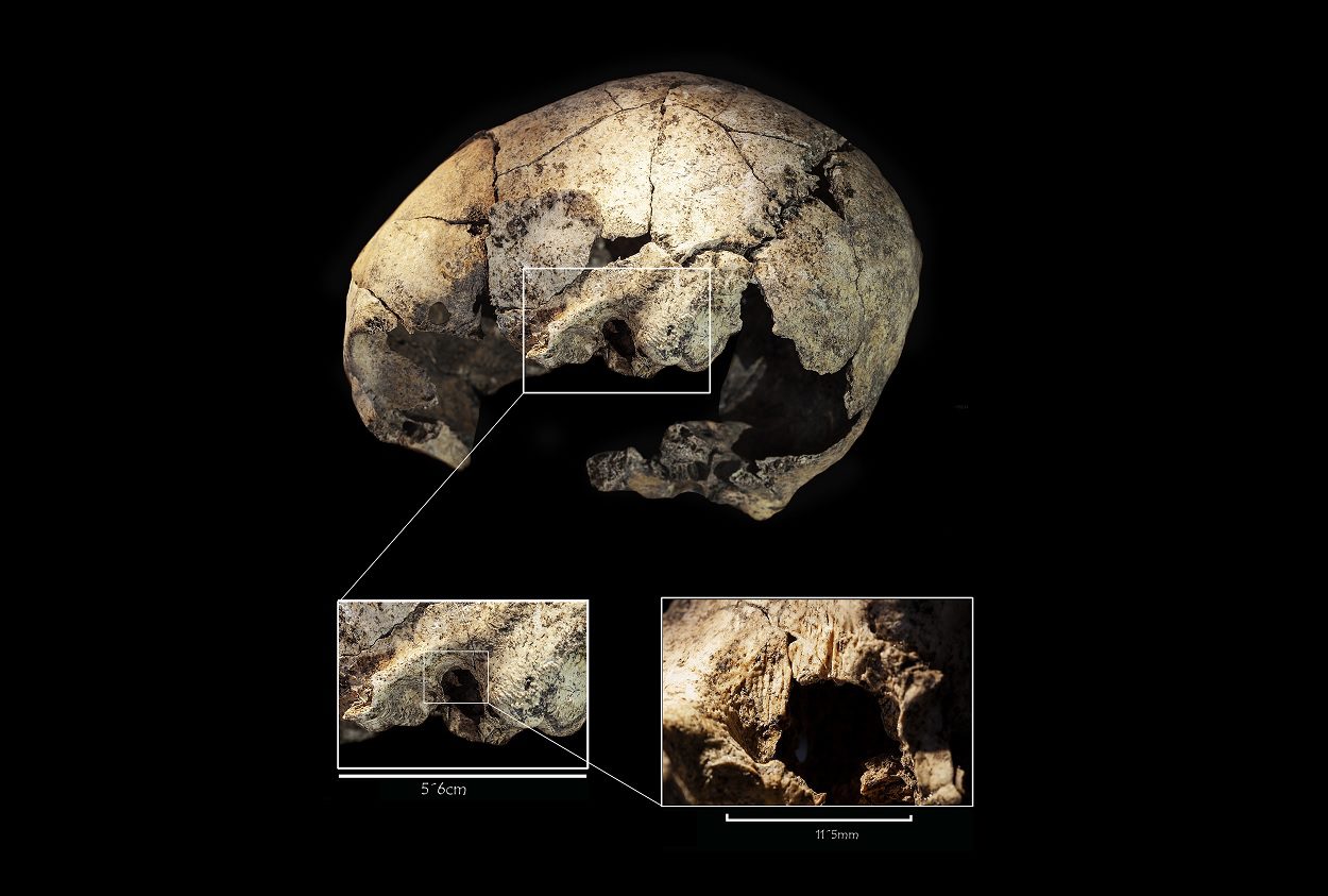 archaeologists find evidence of the first successful ear surgery 5,300 years ago ear