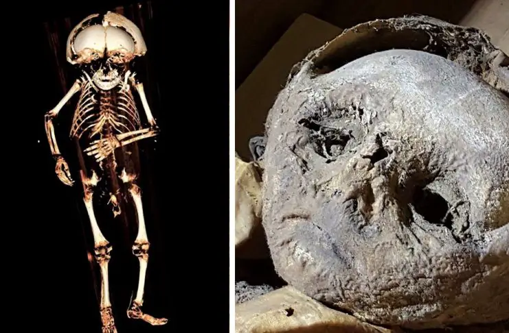 researchers conduct ‘virtual autopsy’ of a mummified 17th century child mummy1